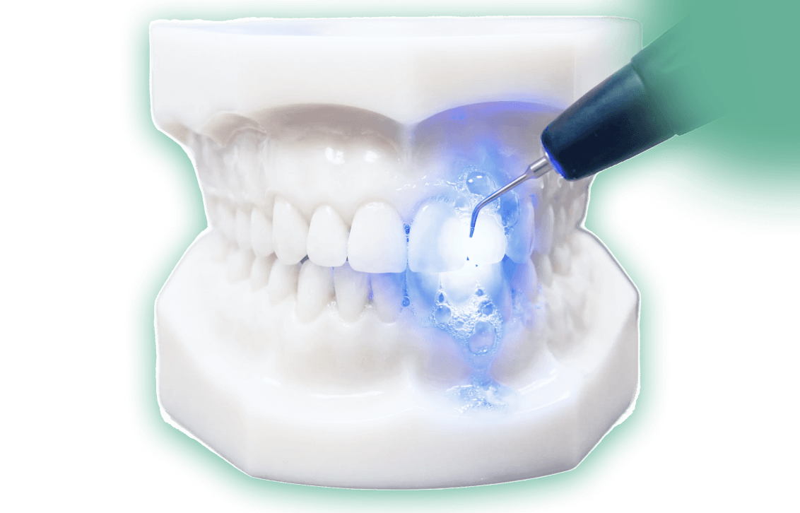 ブルーラジカル治療