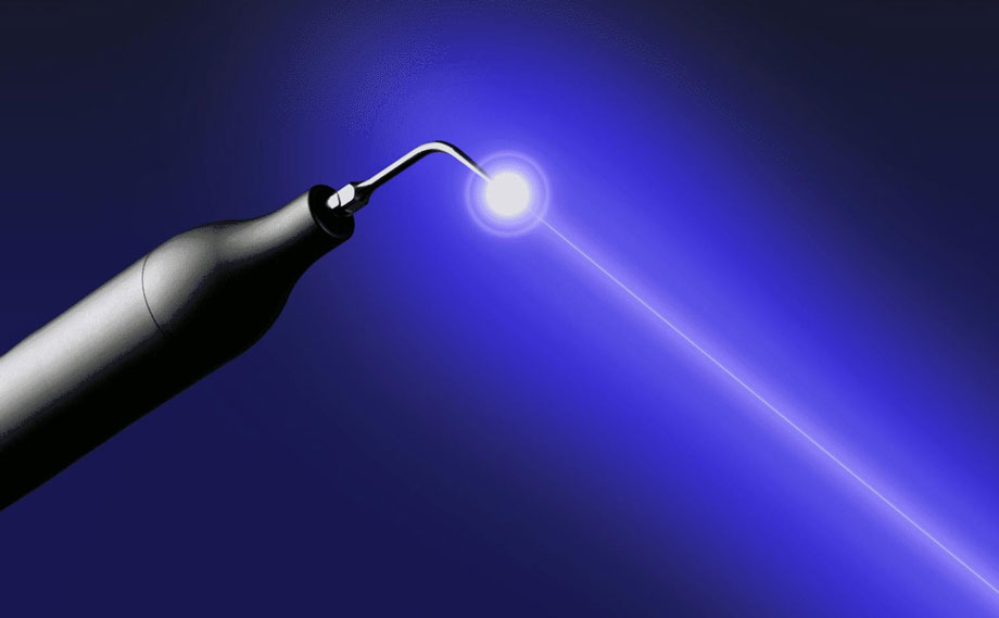 非抜歯を可能にする設備、治療